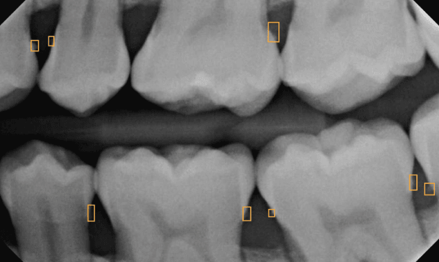 Dental AI Software for DSOs | Overjet