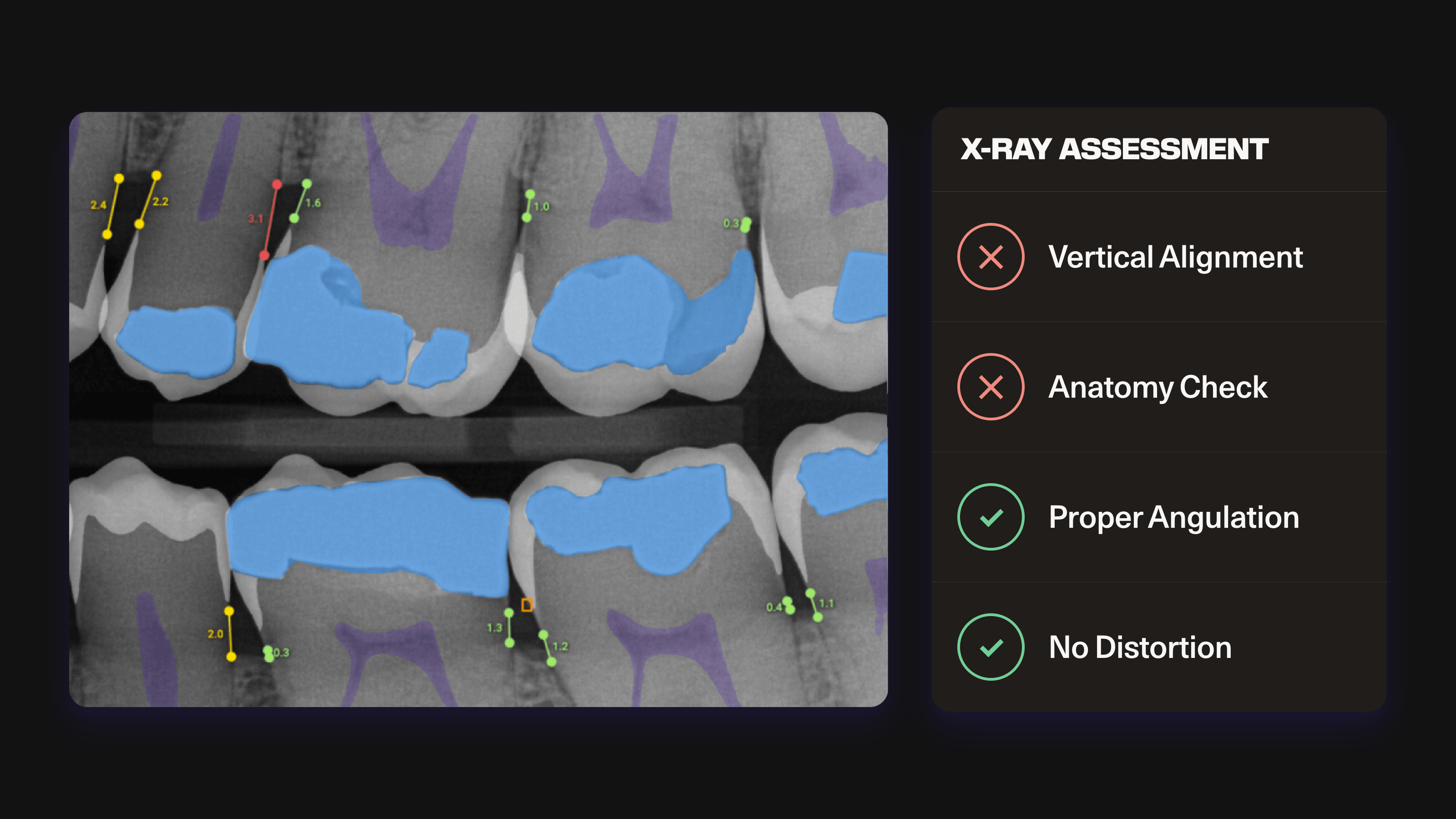 IRIS real-time image quality check showing flagged X-ray issues